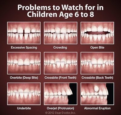 Orthodontic Problems.